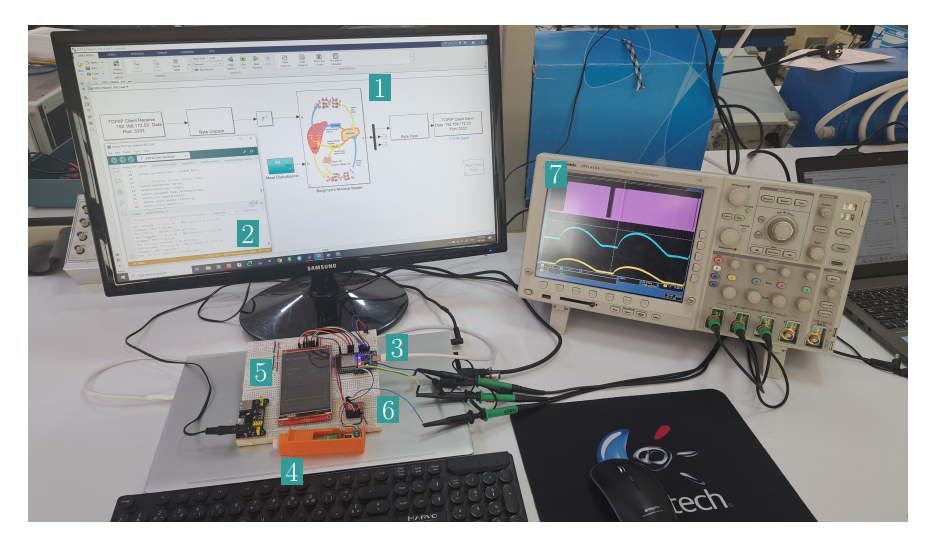 Hardware-in-the-Loop Evaluation of an Embedded Lead Compensator for Automated Insulin Delivery in Type 1 Diabetes